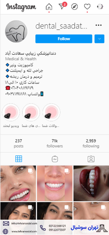 خرید و فروش پیج اینستا دندانپزشکی