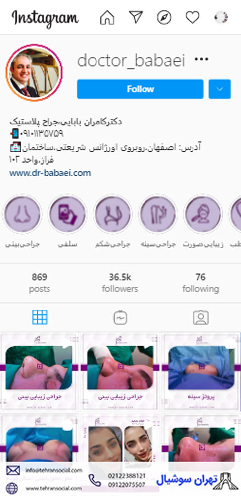 خرید پیج اینستا برای جراحی زیبایی