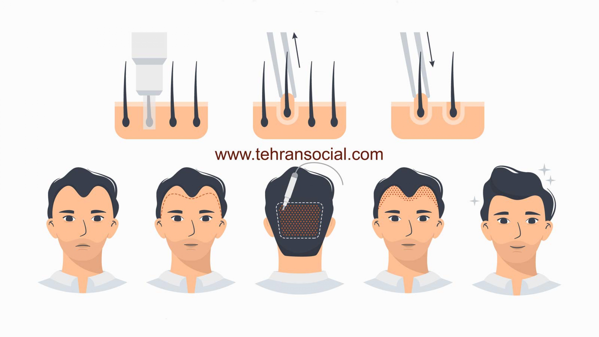 خرید پیج اینستا