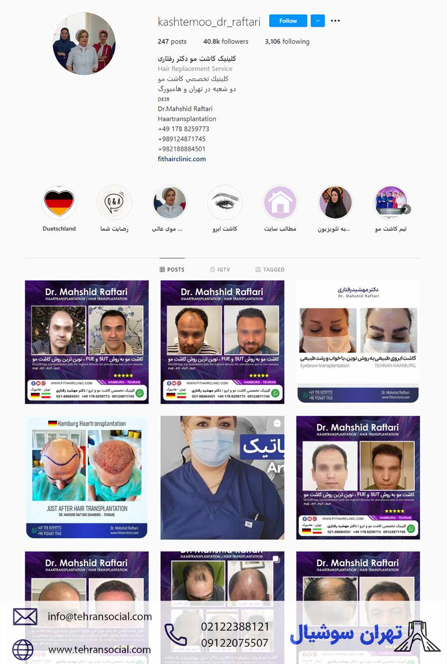 خرید پیج اینستا برای کلینیک کاشت مو